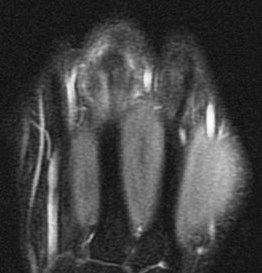 Figure 4 for case Boxers knuckle